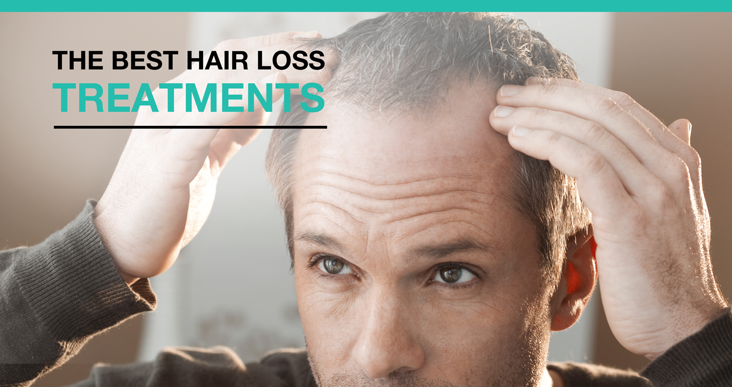 The Best Hair Loss Treatments