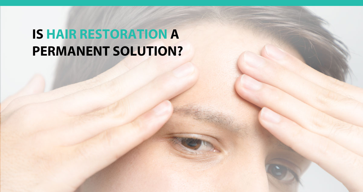 Is Hair Restoration A Permanent Solution?