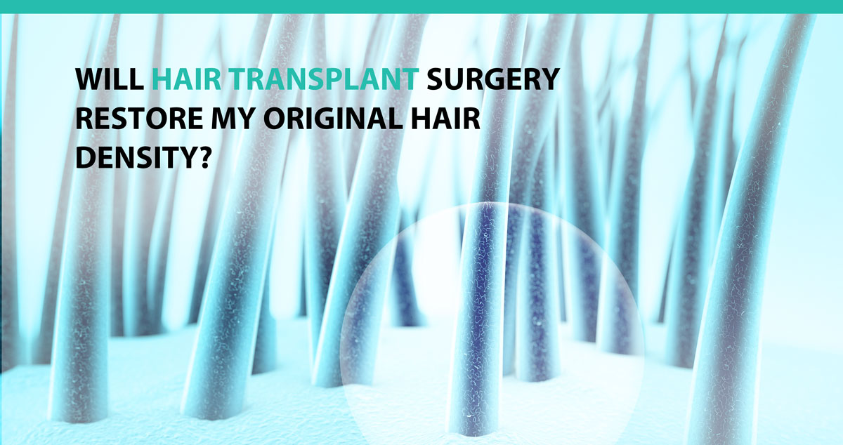 Will Hair Transplant Surgery Restore My Original Hair Density?