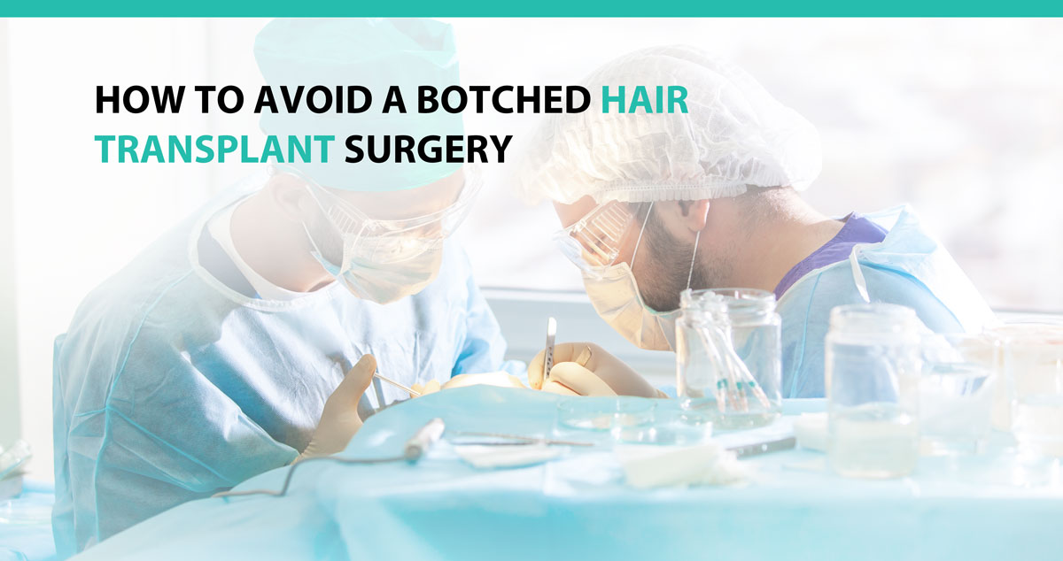 How To Avoid A Botched Hair Transplant Surgery