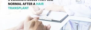 3 Common Issues That Are Normal after a Hair Transplant