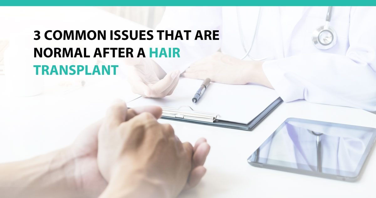 3 Common Issues That Are Normal after a Hair Transplant