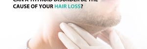 Can A Thyroid Disorder Be the Cause of Your Hair Loss?