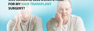 Can Someone Else Donate Hair for My Hair Transplant Surgery?