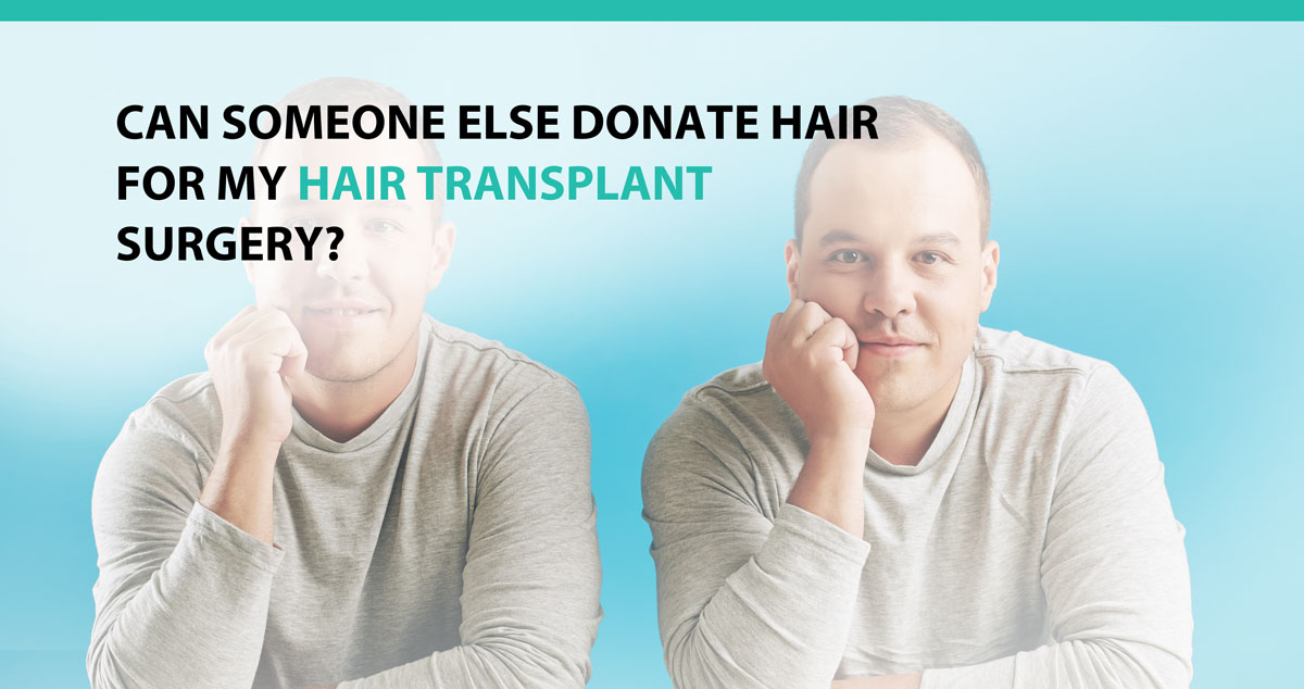 Can Someone Else Donate Hair for My Hair Transplant Surgery?