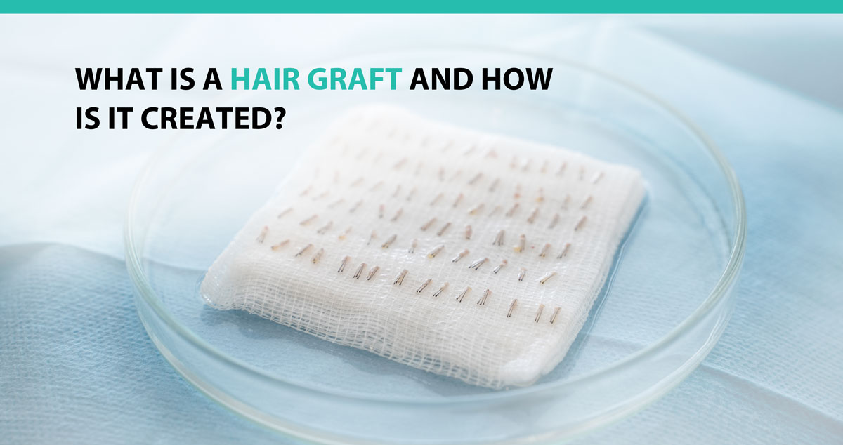 What Is a Hair Graft and How Is It Created?