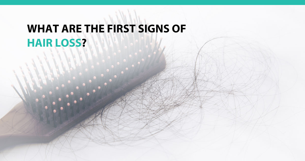 What are the first signs of hair loss?