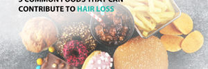 5 Common Foods that Can Contribute to Hair Loss