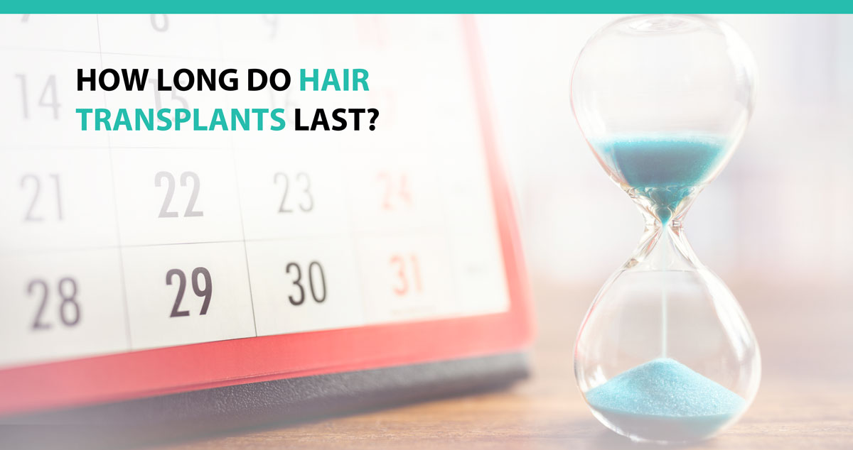 How Long Do Hair Transplants Last?