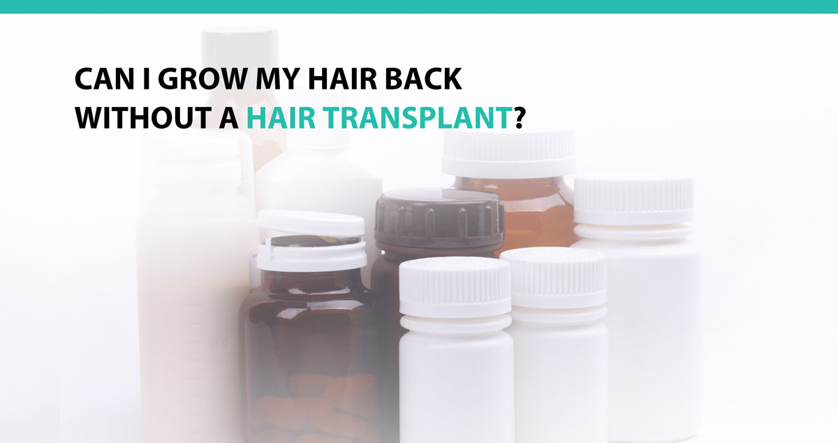 Can I Grow My Hair Back Without a Hair Transplant?