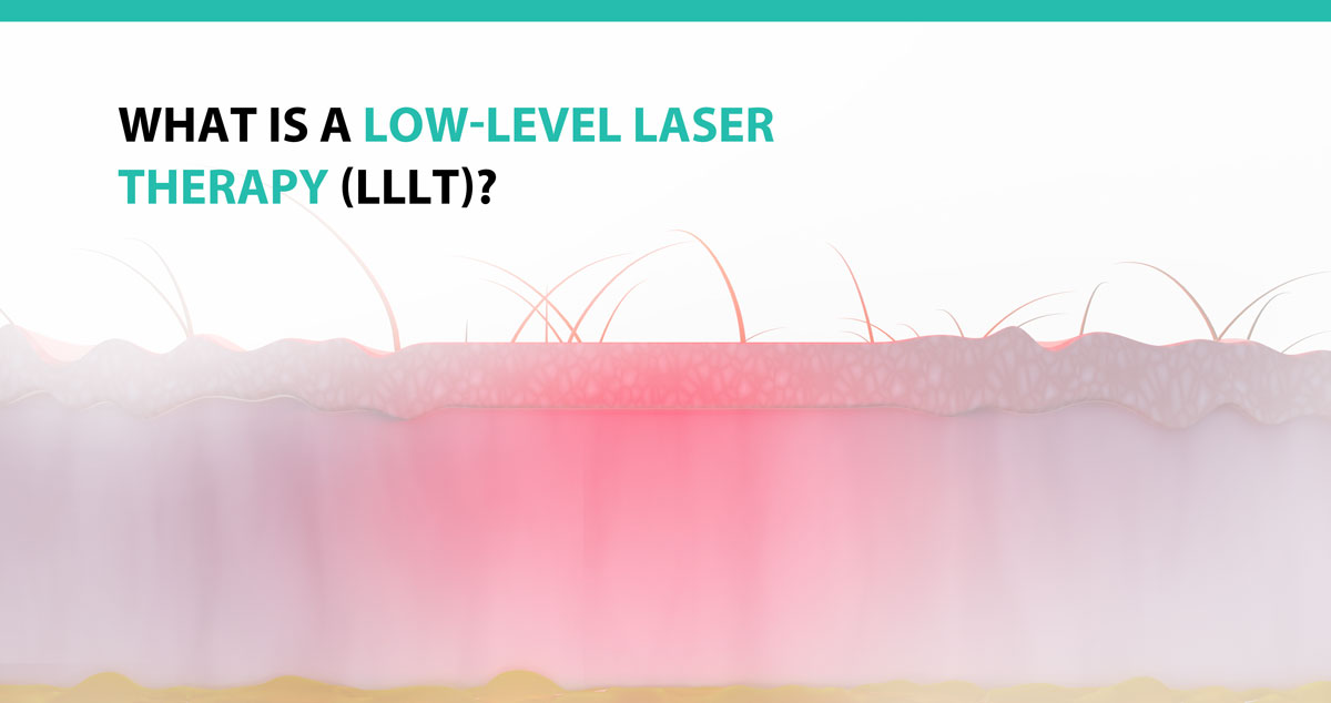 What is a Low-Level Laser Therapy (LLLT)?