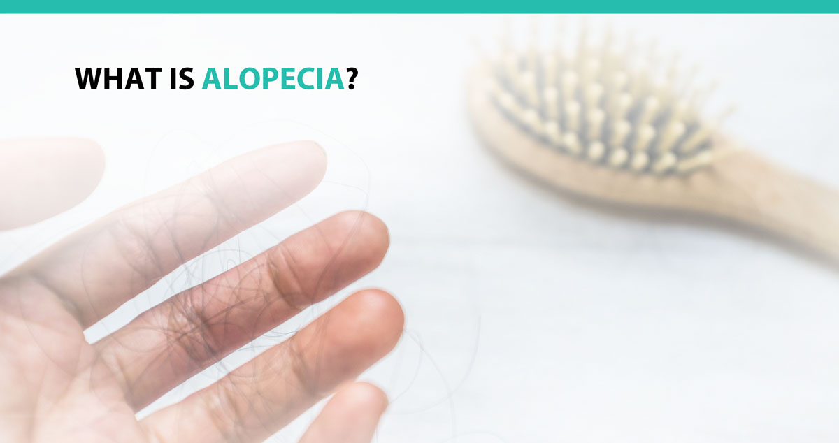 What is Alopecia?