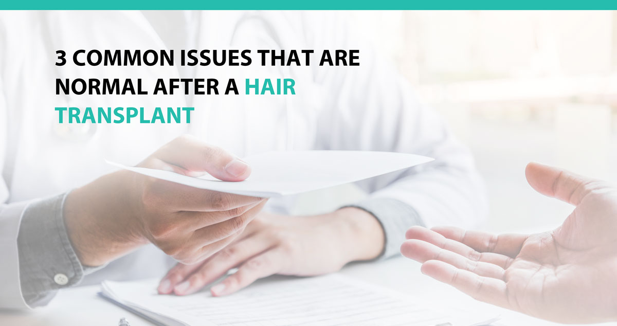 3 Common Issues That Are Normal After A Hair Transplant