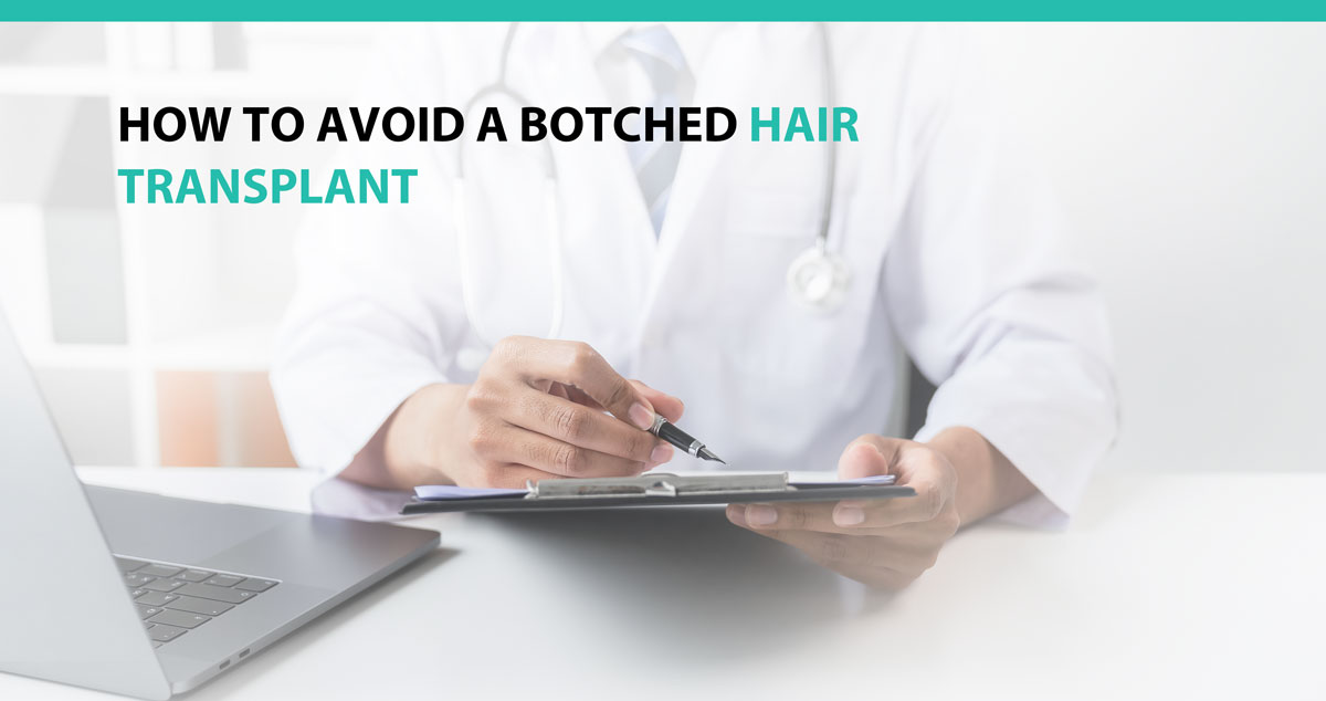How to Avoid a Botched Hair Transplant
