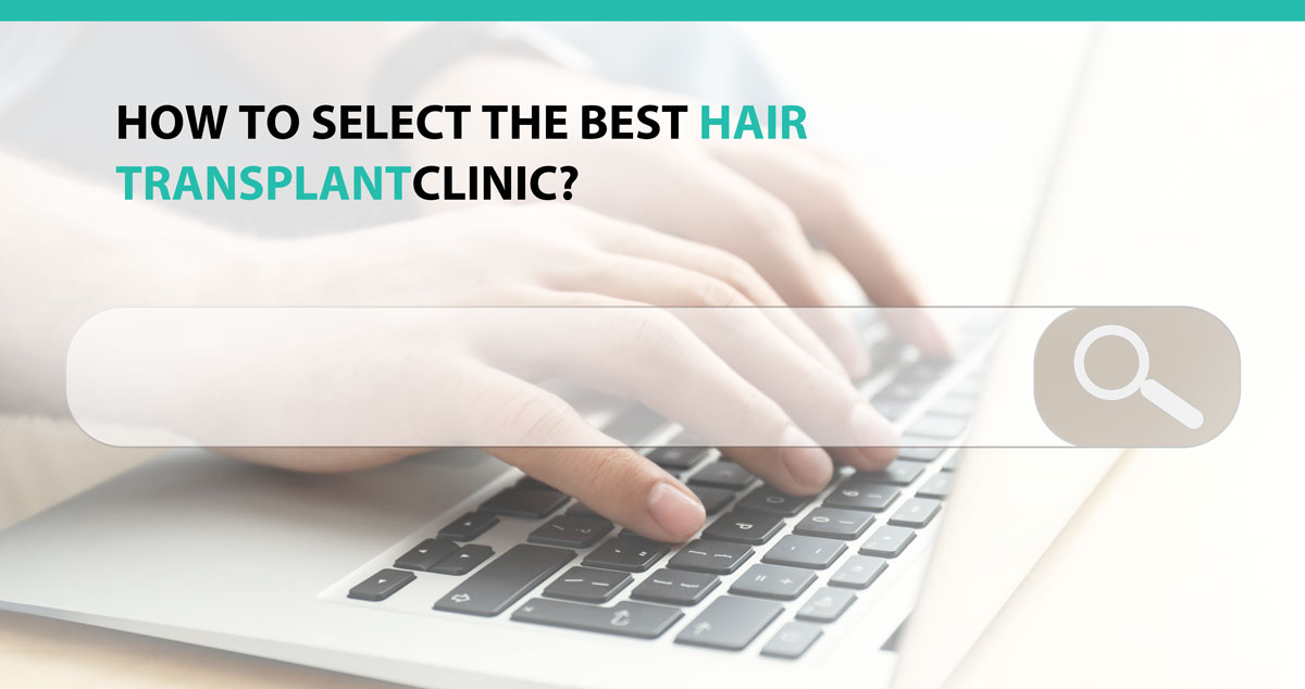 How to Select the Best Hair Transplant Clinic?
