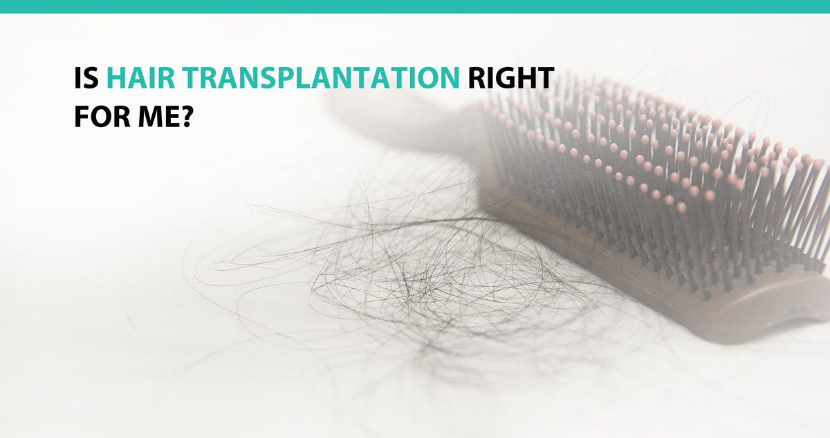 Is Hair Transplantation Right For Me?