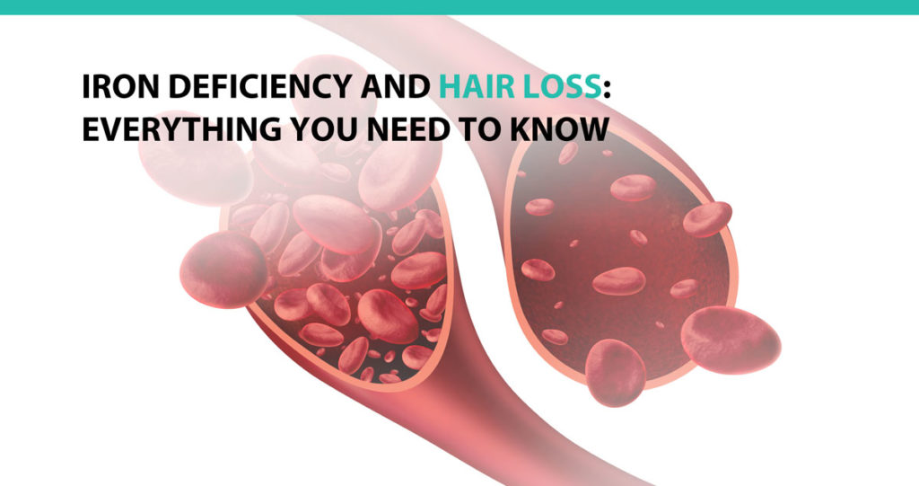 iron-deficiency-and-hair-loss-everything-you-need-to-know-advanced