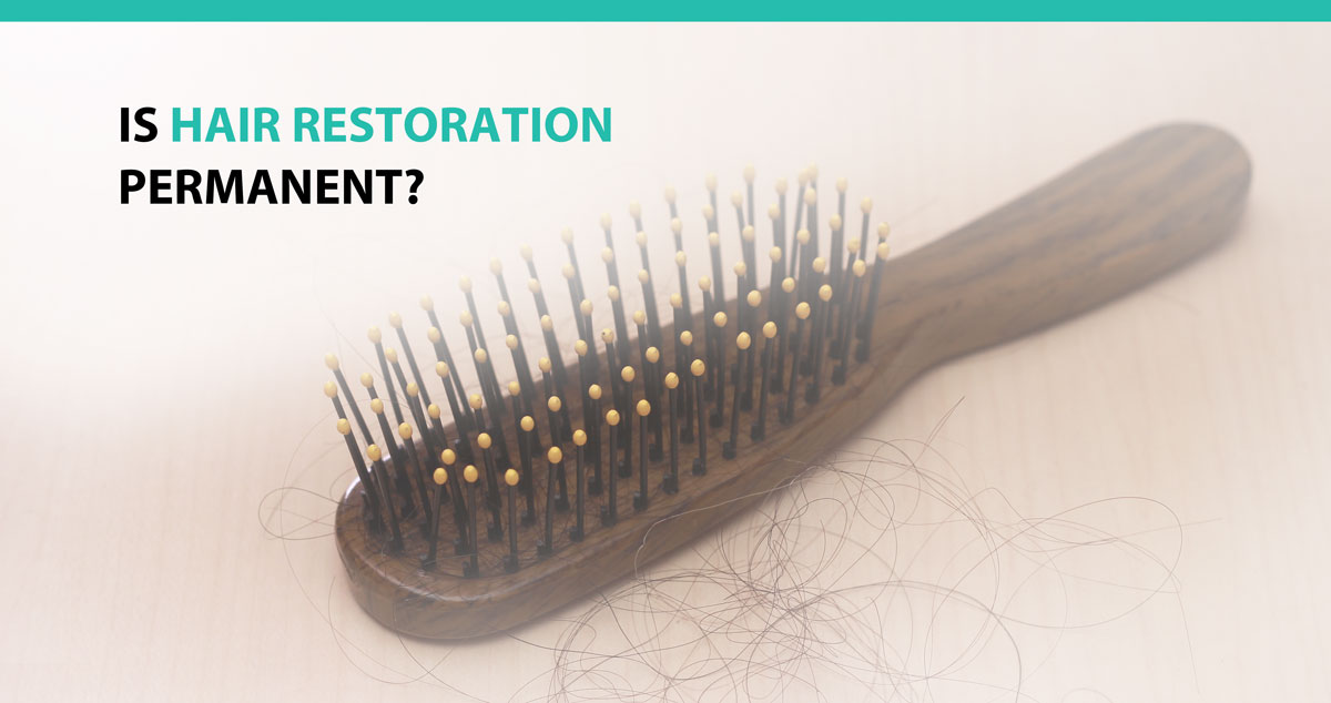 Is Hair Restoration Permanent?