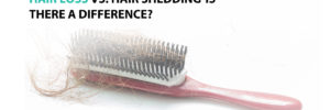 Hair Loss vs. Hair Shedding-Is There a Difference?