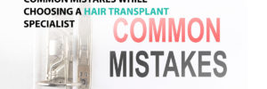 Common Mistakes While Choosing A Hair Transplant Specialist