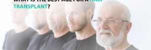 What is the best age for a hair transplant?