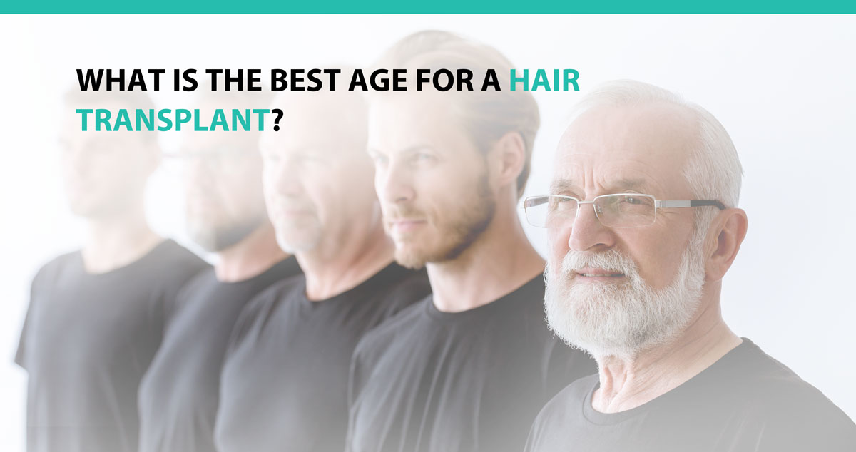 What is the best age for a hair transplant?