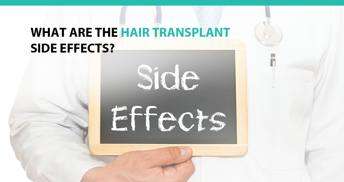 What Are the Hair Transplant Side Effects?