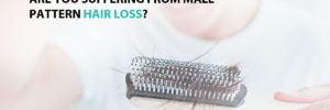 Are You Suffering From Male Pattern Hair Loss?