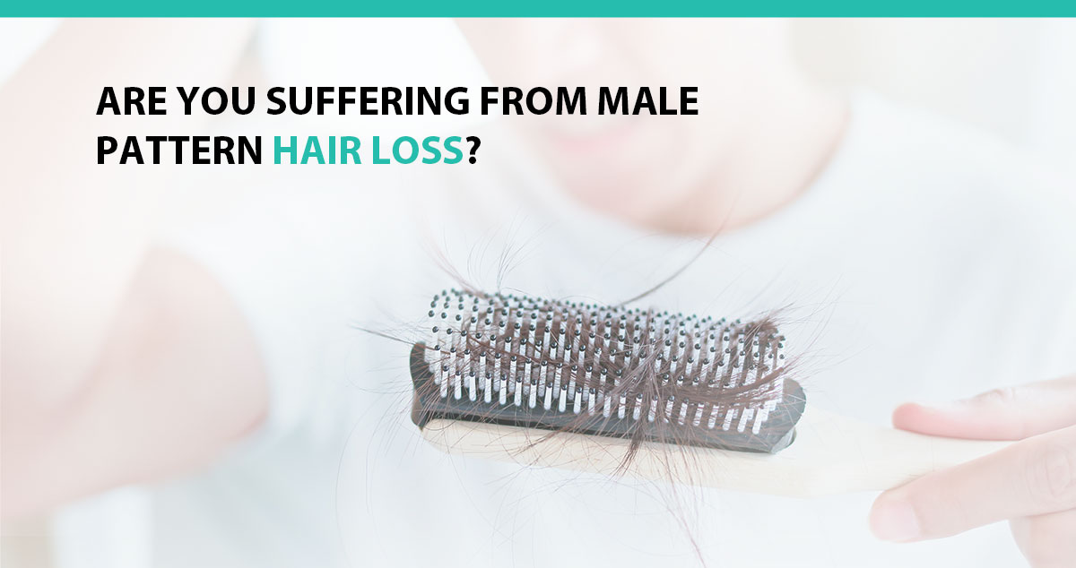 Are You Suffering From Male Pattern Hair Loss?