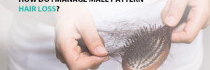 How Do I Manage Male Pattern Hair Loss?