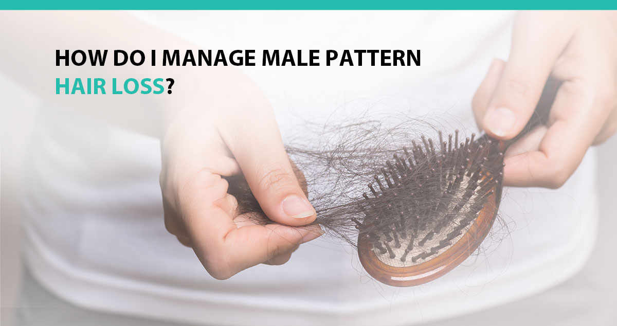 How Do I Manage Male Pattern Hair Loss?