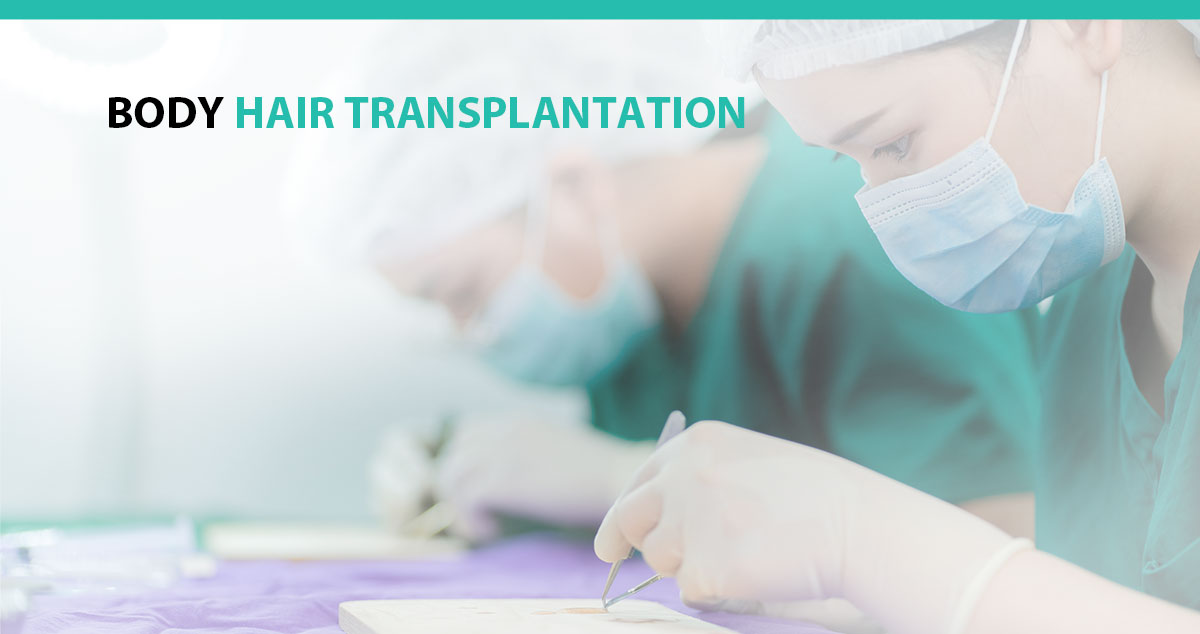 Body Hair Transplantation