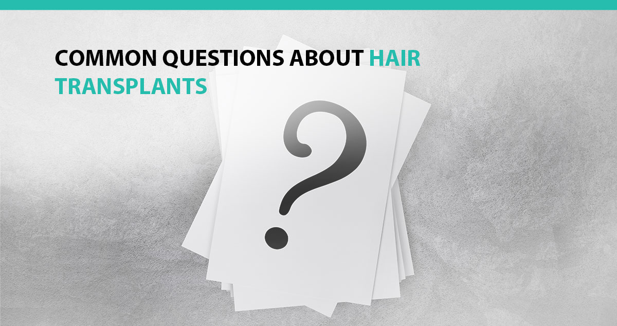 Common Questions About Hair Transplants