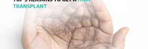 Top 5 Reasons to Get a Hair Transplant