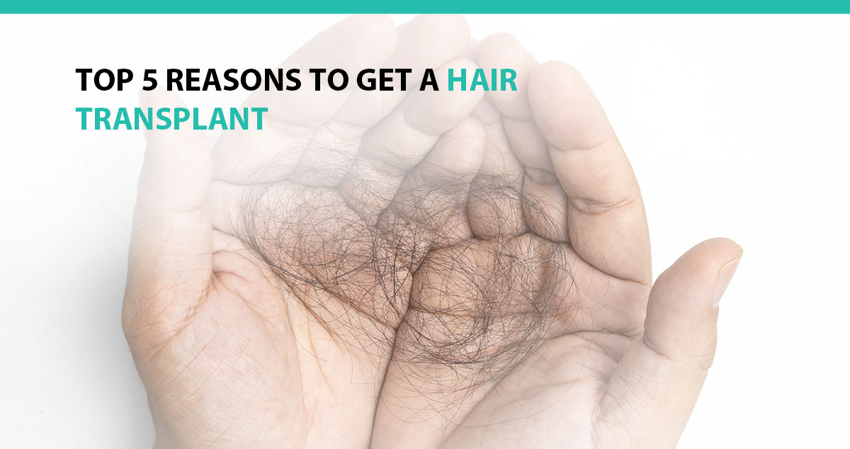 Top 5 Reasons to Get a Hair Transplant