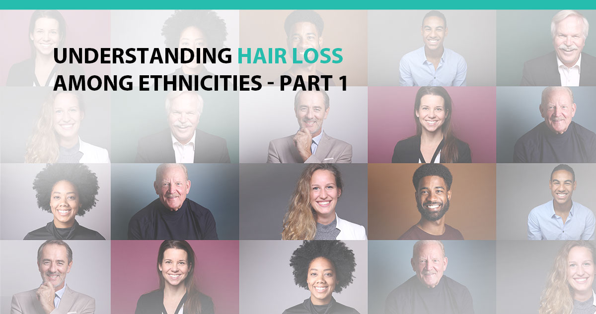 Understanding Hair Loss Among Ethnicities - Part 1