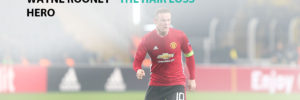 Wayne Rooney - The Hair Loss Hero