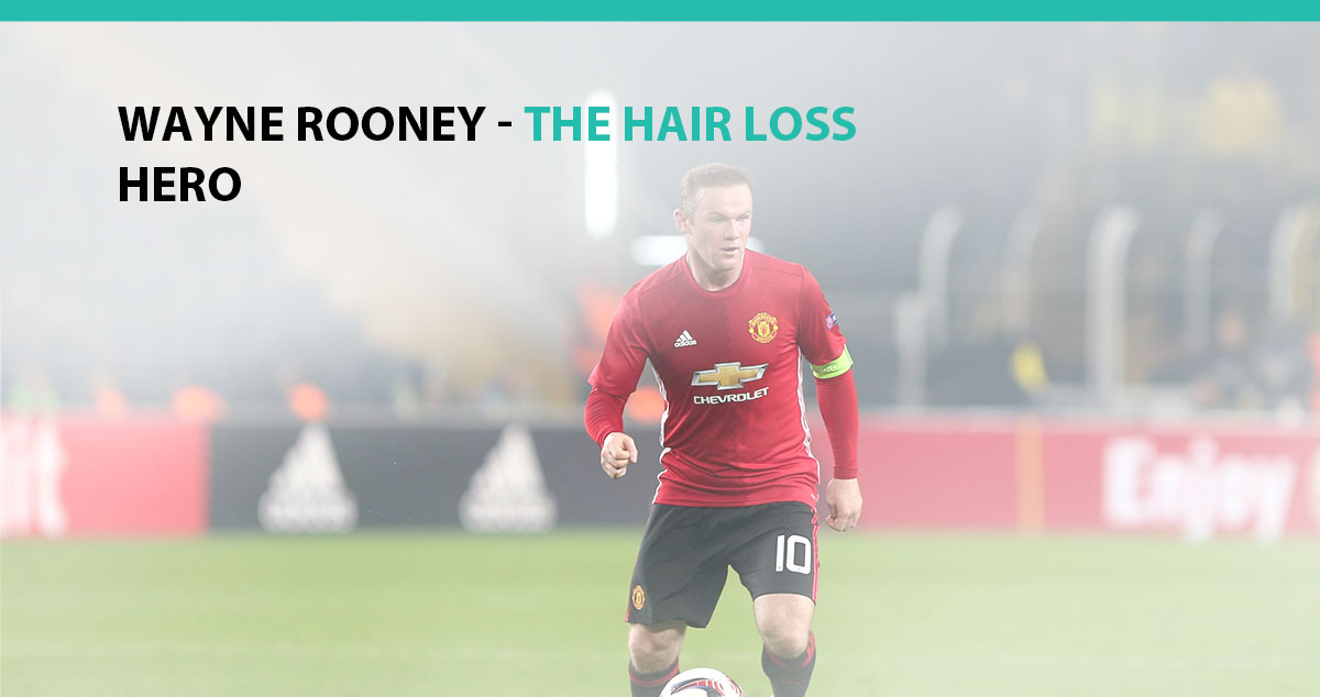 Wayne Rooney - The Hair Loss Hero