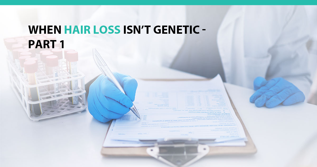 When Hair Loss Isn’t Genetic - Part 1