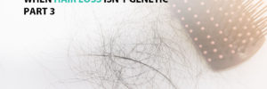 When Hair Loss Isn't Genetic - Part 3