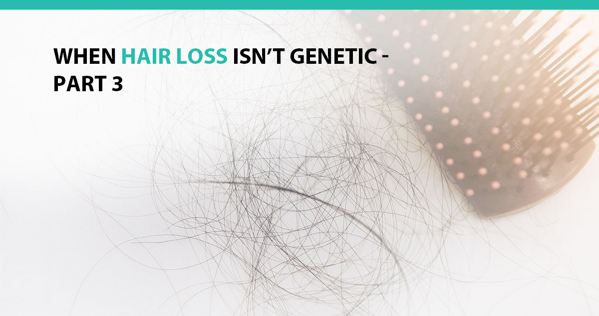 When Hair Loss Isn't Genetic - Part 3