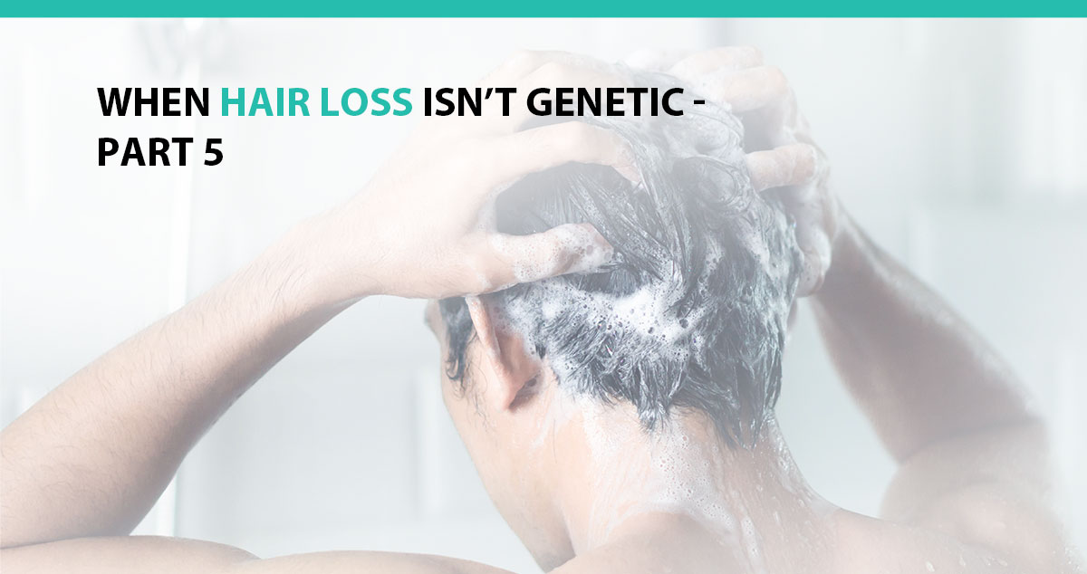 When Hair Loss Isn't Genetic - Part 5