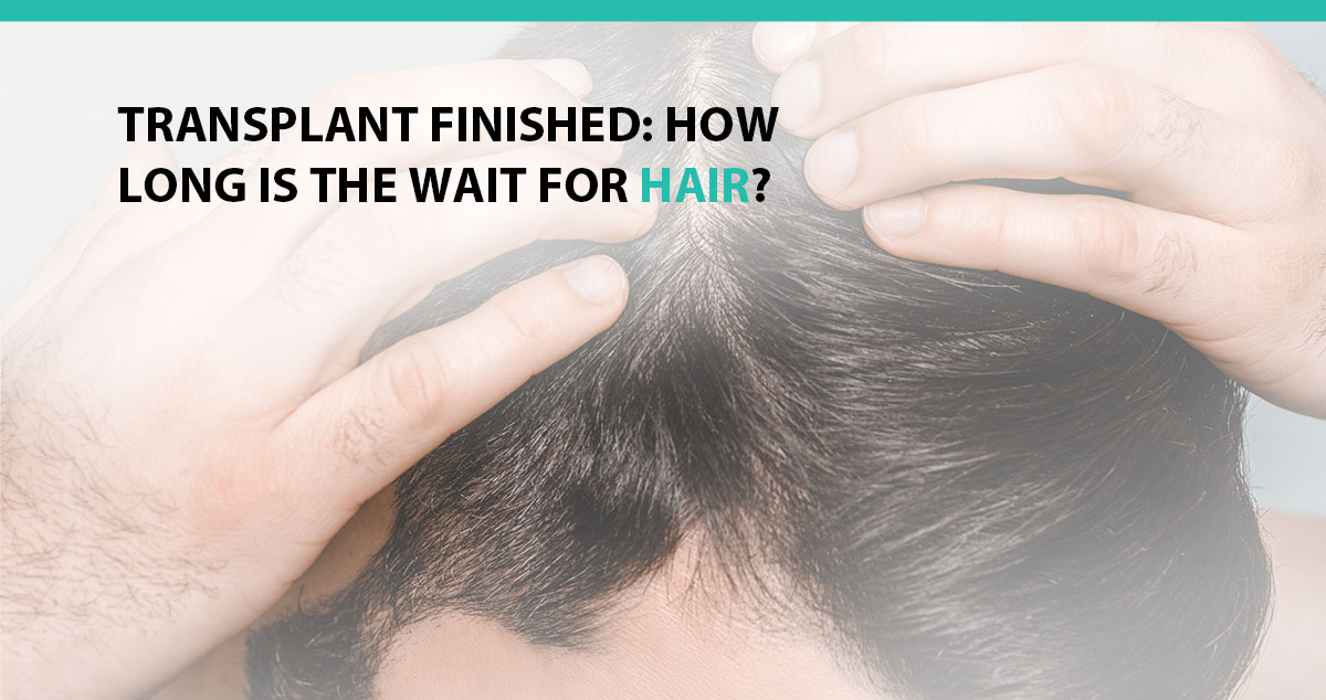 Transplant Finished: How Long Is the Wait for Hair?