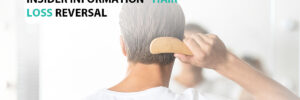 Insider Information - Hair Loss Reversal