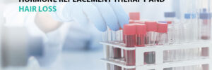 Hormone Replacement Therapy and Hair Loss