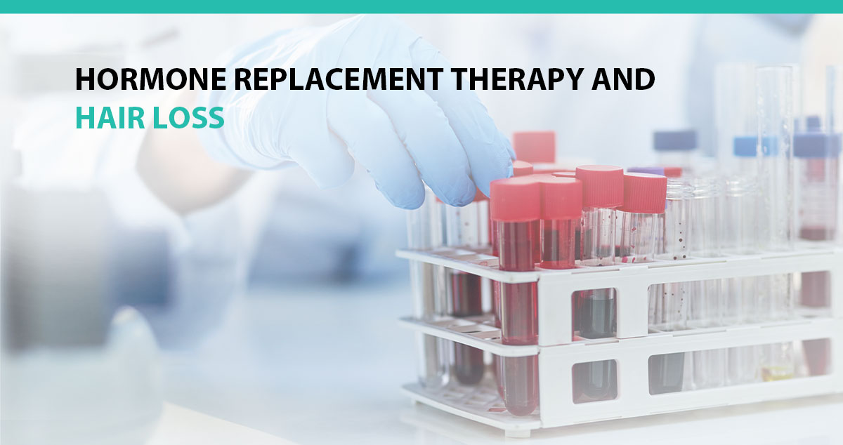 Hormone Replacement Therapy and Hair Loss