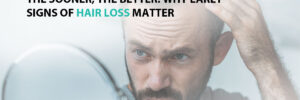 The Sooner, The Better: Why Early Signs of Hair Loss Matter