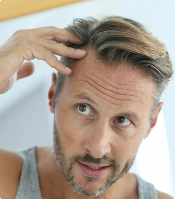 Man checking receding hairline