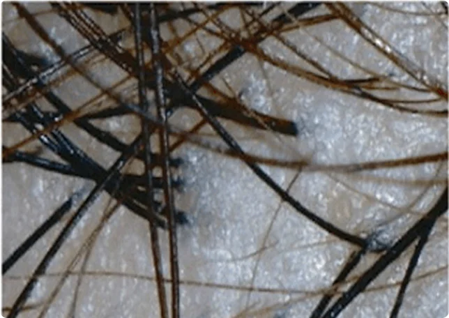 Microscopic hair follicle view