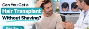 Can You Get a Hair Transplant Without Shaving